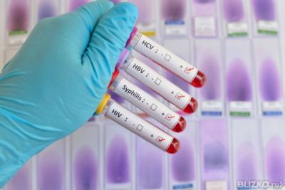 анализ крови на ВИЧ, сифилис, гепатиты
